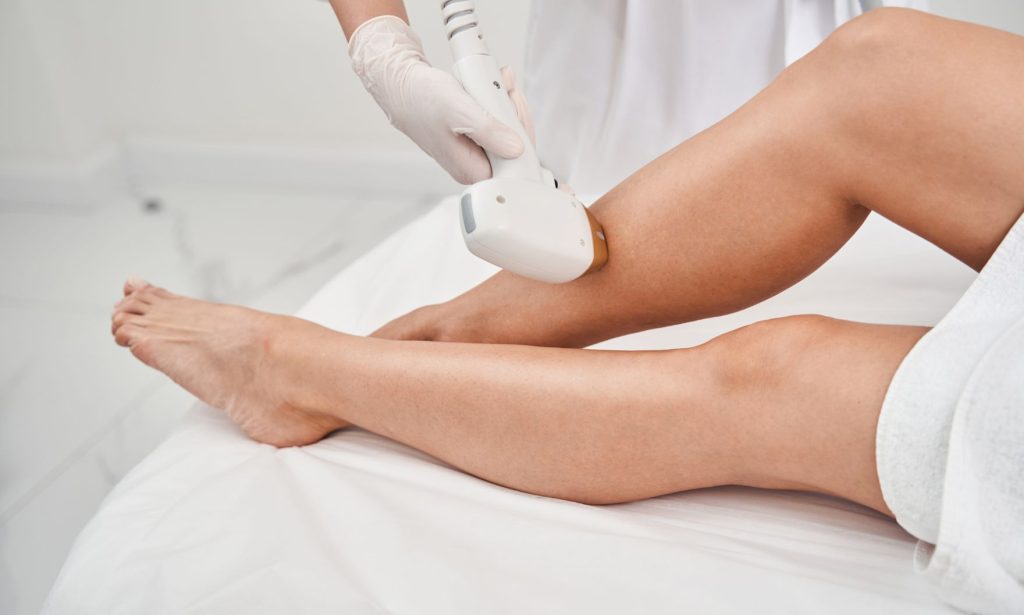 what is considered a small area for laser hair removaL